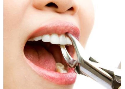 Cheap Wisdom Teeth Removal in Caroline Springs - Parkwood Green Dental