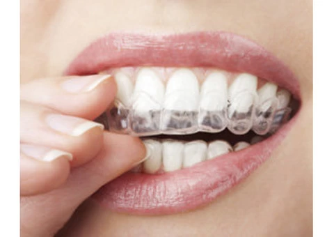 Best Invisalign Clear Braces Melbourne - 2/3