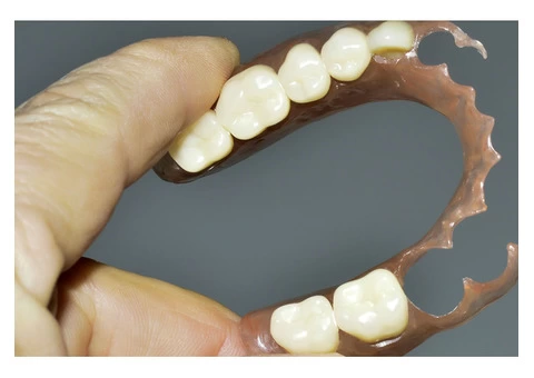 Denture Melbourne - 4/6