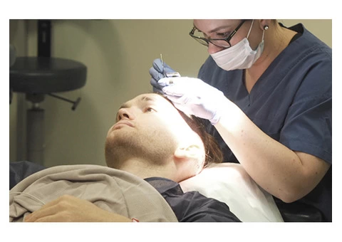 Cost For Hair Transplant Clinic Melbourne - 6/8