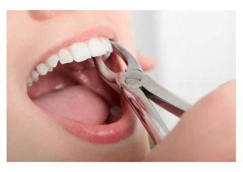Painless Tooth Extraction by the Dentist of Carrum Downs Dental Group