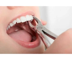 Painless Tooth Extraction by the Dentist of Carrum Downs Dental Group