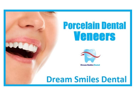 Affordable Dental Veneers in Carlingford, NSW