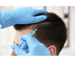 Beard Transplant Australia