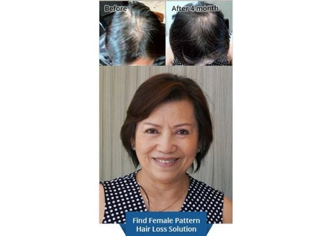 Reliable and Effective Hair Loss Treatment in Brisbane - 2/2