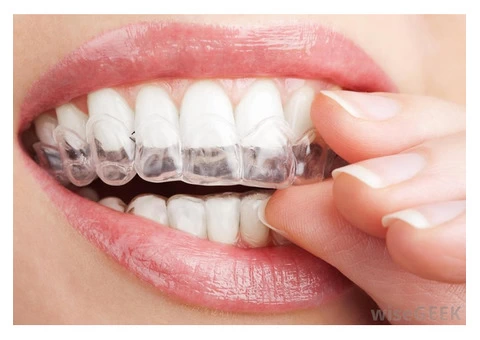 Invisalign Orthodontic Therapy in Neutral Bay, Sydney