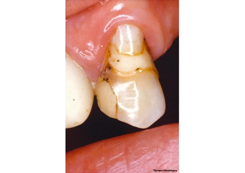 Dental Mammoth Clinical Databases – Ebmg