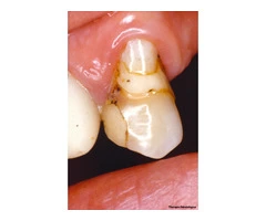 Dental Mammoth Clinical Databases – Ebmg