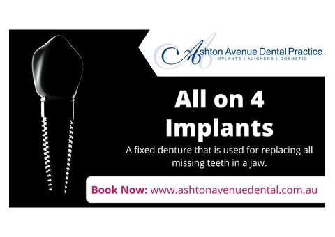 Who can Benefit from All on 4 Dental Implants?