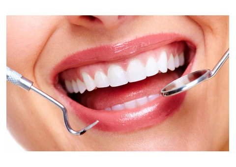 Best Teeth Whitening - (03-95788500) - BEDC