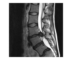 Contact us for World-class Spinal Neurosurgery in Melbourne