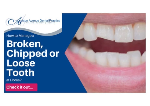 How to Manage a Broken, Chipped or Loose Tooth at Home?