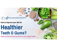How to Improve Your Diet for Healthier Teeth and Gums?