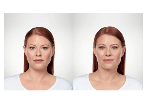 Keyword kybella vs coolsculpting