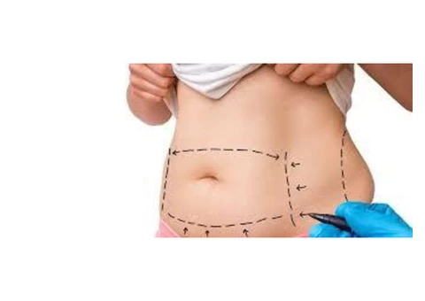Safer and Effective Liposuction Procedure in Melbourne From Chelsea Cosmetics! - 2/4