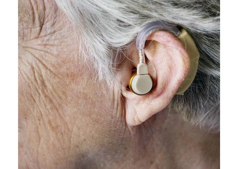 Hearing Aids at HASSA: Low on Rate but High on Quality