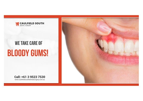 Ensure Healthy Gums with Gum Disease Treatment in Melbourne