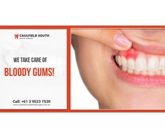 Ensure Healthy Gums with Gum Disease Treatment in Melbourne