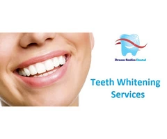Teeth Whitening - Effective way of lightening the natural colour of your Teeth