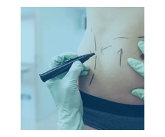 Top Tummy Tuck Surgeon In Sydney