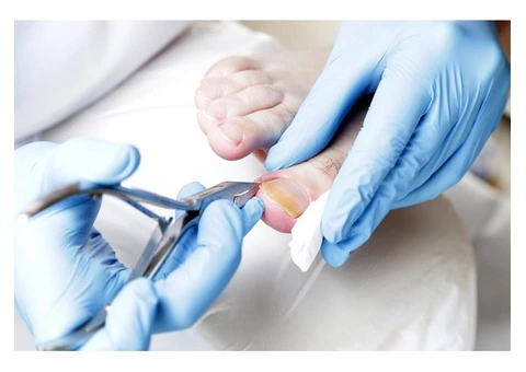 Choose Foot & Sole Podiatry for Ingrown Toenail Home Treatment