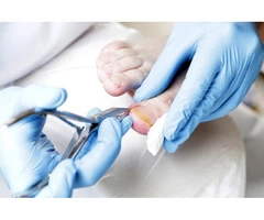 Choose Foot & Sole Podiatry for Ingrown Toenail Home Treatment