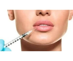 Lip Filler In Canberra | Best Skin Treatments in Australia