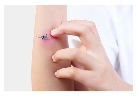 Bothered About Mosquito Bites? Follow These Tips for Quick Relief