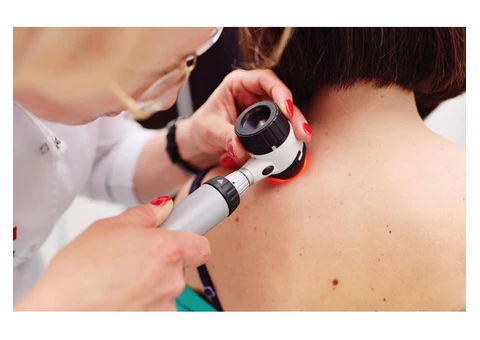 Skin Cancer Check Melbourne - Manningham Skin Cancer Clinic