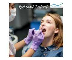 All About Root Canal Treatment | United Dental Clinic