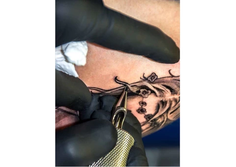 Choose Trusted Tattoo Removal Clinic Sydney
