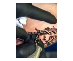 Choose Trusted Tattoo Removal Clinic Sydney