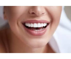 Affordable Cost for Composite Veneers in Melbourne