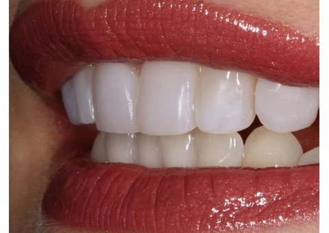 Best Cosmetic Dentist in Sydney - 2/7