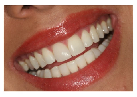 Best Cosmetic Dentist in Sydney - 5/7