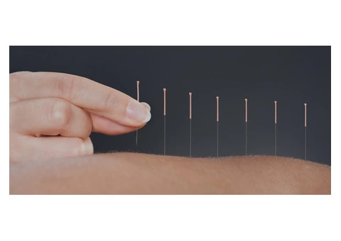 Best Acupuncture in Melbourne | Balance Complementary Medicine - 1/7