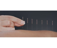 Best Acupuncture in Melbourne | Balance Complementary Medicine