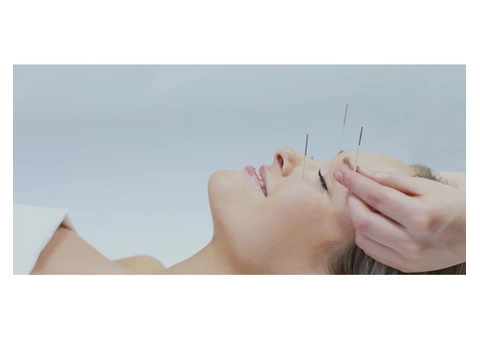 Best Acupuncture in Melbourne | Balance Complementary Medicine - 2/7