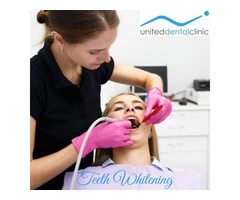 Life Lessons Teeth whitening Services Taught Us | United Dental Clinic