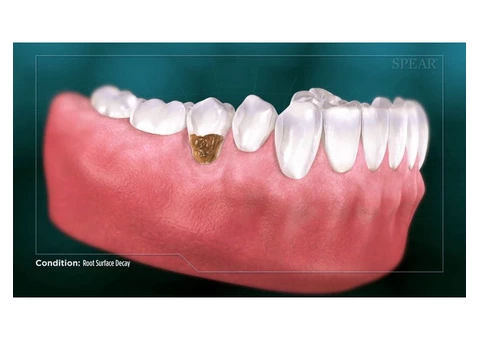 Complete Dental Oral Surgery and Implants