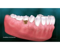 Complete Dental Oral Surgery and Implants