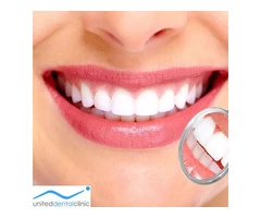 All-On-4 Dental Treatment by United Dental Clinic