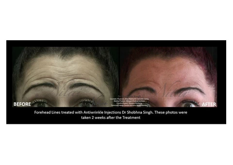 Buy Obagi Skincare Products Online | CRX System, Elastiderm Eye Treatment &amp - 1/4