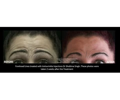 Buy Obagi Skincare Products Online | CRX System, Elastiderm Eye Treatment &amp