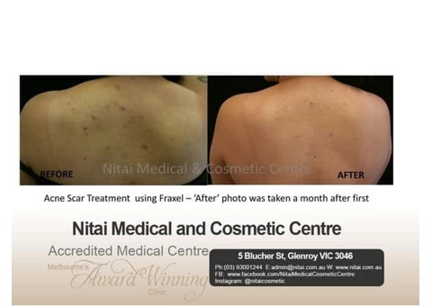 Buy Obagi Skincare Products Online | CRX System, Elastiderm Eye Treatment &amp - 2/4