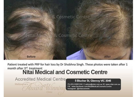 Buy Obagi Skincare Products Online | CRX System, Elastiderm Eye Treatment &amp - 3/4