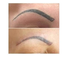 Eyebrow Tattoo for a Good Eye Looks