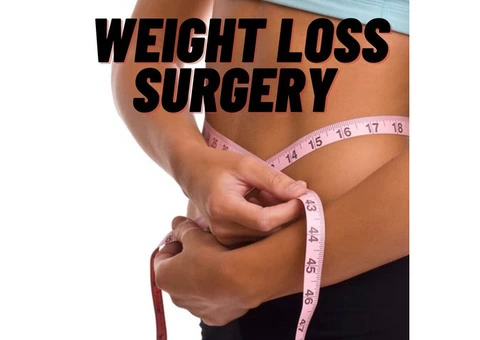 Weight loss surgery | just a few steps away from a lovely toned body
