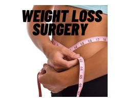 Weight loss surgery | just a few steps away from a lovely toned body