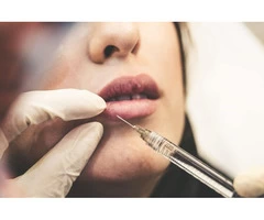Plastic surgery loans | Aid for a beautiful appearance with little steps